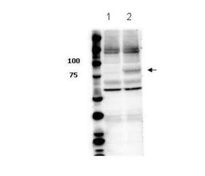 Western Blot: STAT3 [p Tyr705] Antibody [NBP2-19129]